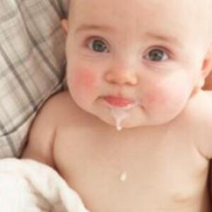 Bebe mange